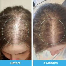Load image into Gallery viewer, Postpartum Hair Loss Vitamins