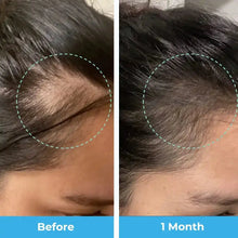 Load image into Gallery viewer, Postpartum Hair Loss Vitamins
